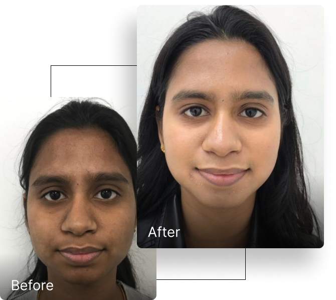Before and after result 1