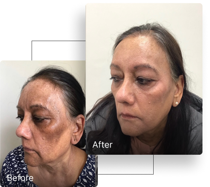 Before and after result 5