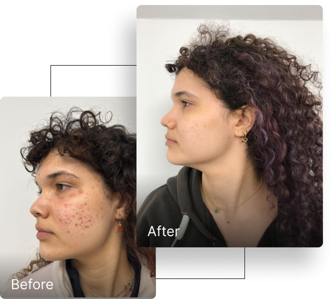 Before and after result 4